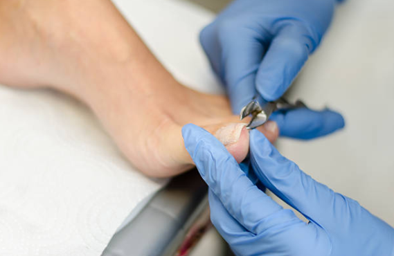 Trimming and filing of nails